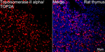 TOP2A Antibody in Immunohistochemistry (Paraffin) (IHC (P))