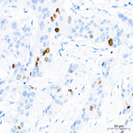TOP2A Antibody in Immunohistochemistry (Paraffin) (IHC (P))