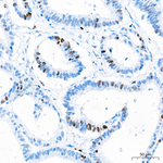 TOP2A Antibody in Immunohistochemistry (Paraffin) (IHC (P))