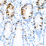 TOP2A Antibody in Immunohistochemistry (Paraffin) (IHC (P))