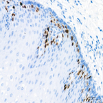 TOP2A Antibody in Immunohistochemistry (Paraffin) (IHC (P))