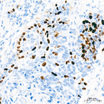 TOP2A Antibody in Immunohistochemistry (Paraffin) (IHC (P))