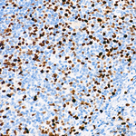TOP2A Antibody in Immunohistochemistry (Paraffin) (IHC (P))