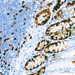 TOP2A Antibody in Immunohistochemistry (Paraffin) (IHC (P))