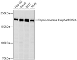 TOP2A Antibody in Western Blot (WB)