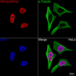 RPA2 Antibody in Immunocytochemistry (ICC/IF)