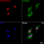 RPA2 Antibody in Immunocytochemistry (ICC/IF)