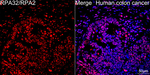 RPA2 Antibody in Immunohistochemistry (Paraffin) (IHC (P))