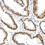 RPA2 Antibody in Immunohistochemistry (Paraffin) (IHC (P))
