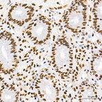 RPA2 Antibody in Immunohistochemistry (Paraffin) (IHC (P))