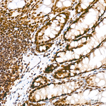 RPA2 Antibody in Immunohistochemistry (Paraffin) (IHC (P))