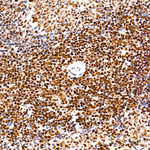 RPA2 Antibody in Immunohistochemistry (Paraffin) (IHC (P))