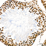 RPA2 Antibody in Immunohistochemistry (Paraffin) (IHC (P))