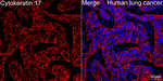 Cytokeratin 17 Antibody in Immunohistochemistry (Paraffin) (IHC (P))