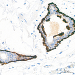 Cytokeratin 17 Antibody in Immunohistochemistry (Paraffin) (IHC (P))