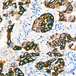 Cytokeratin 17 Antibody in Immunohistochemistry (Paraffin) (IHC (P))