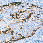 Cytokeratin 17 Antibody in Immunohistochemistry (Paraffin) (IHC (P))