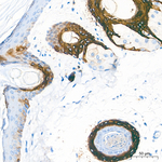 Cytokeratin 17 Antibody in Immunohistochemistry (Paraffin) (IHC (P))
