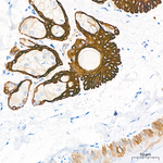 Cytokeratin 17 Antibody in Immunohistochemistry (Paraffin) (IHC (P))