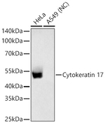 Cytokeratin 17 Antibody in Western Blot (WB)