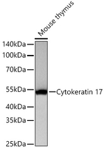 Cytokeratin 17 Antibody in Western Blot (WB)