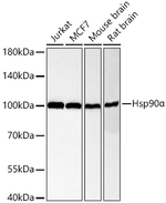 HSP90 alpha Recombinant Rabbit Monoclonal Antibody (4E4S4)