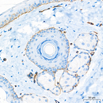 CD49f Antibody in Immunohistochemistry (Paraffin) (IHC (P))