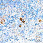 CD49f Antibody in Immunohistochemistry (Paraffin) (IHC (P))