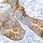 CD49f Antibody in Immunohistochemistry (Paraffin) (IHC (P))