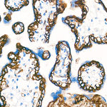 CD49f Antibody in Immunohistochemistry (Paraffin) (IHC (P))