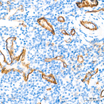 CD49f Antibody in Immunohistochemistry (Paraffin) (IHC (P))