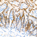 CD49f Antibody in Immunohistochemistry (Paraffin) (IHC (P))