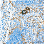 CD49f Antibody in Immunohistochemistry (Paraffin) (IHC (P))