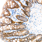 CD49f Antibody in Immunohistochemistry (Paraffin) (IHC (P))