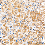 SREBP1 Antibody in Immunohistochemistry (Paraffin) (IHC (P))