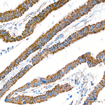 MCCC2 Antibody in Immunohistochemistry (Paraffin) (IHC (P))