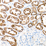 MCCC2 Antibody in Immunohistochemistry (Paraffin) (IHC (P))