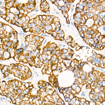 MCCC2 Antibody in Immunohistochemistry (Paraffin) (IHC (P))
