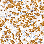 MCCC2 Antibody in Immunohistochemistry (Paraffin) (IHC (P))