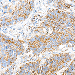MCCC2 Antibody in Immunohistochemistry (Paraffin) (IHC (P))