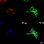 CBP Antibody in Immunocytochemistry (ICC/IF)