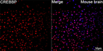 CBP Antibody in Immunohistochemistry (Paraffin) (IHC (P))