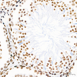 CBP Antibody in Immunohistochemistry (Paraffin) (IHC (P))