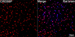 CBP Antibody in Immunohistochemistry (Paraffin) (IHC (P))