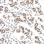 CBP Antibody in Immunohistochemistry (Paraffin) (IHC (P))
