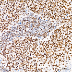 CBP Antibody in Immunohistochemistry (Paraffin) (IHC (P))