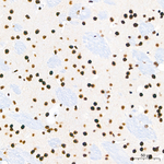 CBP Antibody in Immunohistochemistry (Paraffin) (IHC (P))
