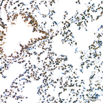 CBP Antibody in Immunohistochemistry (Paraffin) (IHC (P))