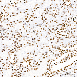 CBP Antibody in Immunohistochemistry (Paraffin) (IHC (P))