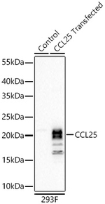 TECK Recombinant Rabbit Monoclonal Antibody (2U5J2)
